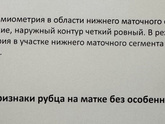 Рубец 0,9 мм