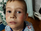 Мой очкарик) и мой раненый боец🤕😆