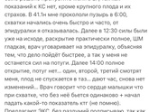 Расскажите свои роды?