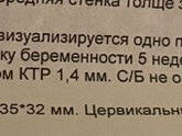 26дпп, криоперенос в ец, коричневые выделения
