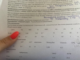 Мертворождение