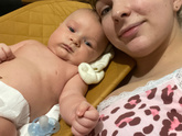 Желтуха в 2 месяца , как быстрее вывести