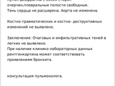 Что то серьезное ?
