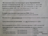 Была сегодня на первом