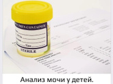Анализ мочи