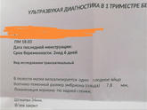 Во сколько недель