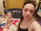 Я и виновник моего прекрасного глаза ?