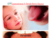 Продолжение про вкусовые сосочки👅