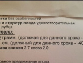 Третий скрининг ❤️ 33 недели