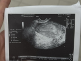 Узи🤰