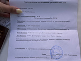 11 д.ц. Стимуляция клостилбегитом 25 мг с 5 по 9й день