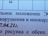 ЭКГ! Подскажите