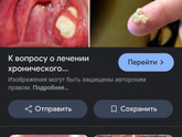 Болит горло