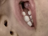 Зубы