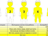 Желтушка?