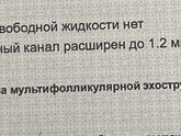 Была на фолликулометрии,овуляции на