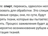 Пирсинг хеликс