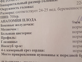 Девочки, была на узи,