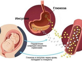 ГСД с инсулином.