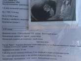Заоболочечная гематома