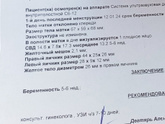 Узи