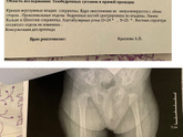 Снимок таза.