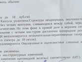 УЗИ ЩЖ