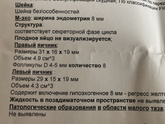 Биохимическая беременность