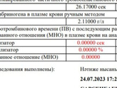Посмотрите анализ Чем это