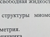 Узи