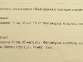 Жт 18мм, сделала узи