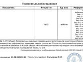 Хгч
