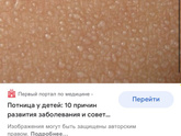 Потничка у сына 5 лет