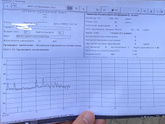 Помогите расшифровать КТГ