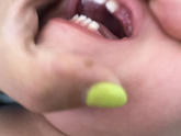 Зубы