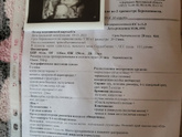 2 скрининг дубль 2)))?