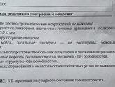 КТ головного мозга 🆘🆘🆘