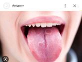 Девочки, кто сталкивался