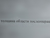 Рубец