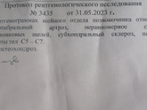 Шейный артроз