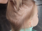 От чего могут ломаться волосы у ребенка