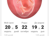 УЗИ
