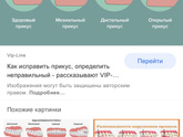 Неправильный прикус
