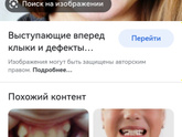 Аденоиды