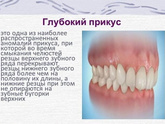 Глубокий прикус