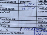 Субклинический гипотериоз