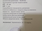 Девочки, кто разбирается, ктр