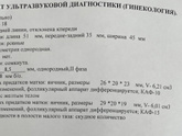 Сходила на УЗИ