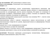 Мрт