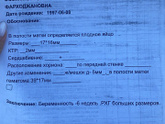 Гематома 4 см